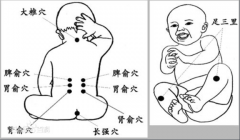 捏脊療法