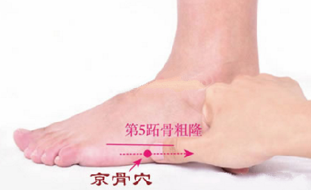 京骨穴的配伍應(yīng)用