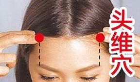 頭維穴的主治病癥