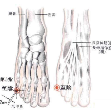 胎兒胎位不正怎么辦？艾灸至陰穴可矯正胎位