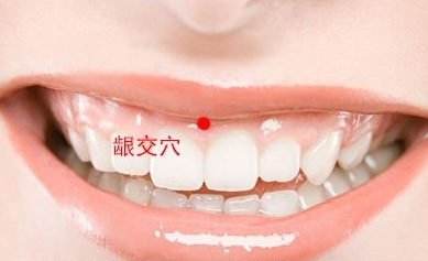 齦交穴示意圖