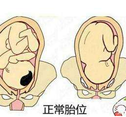 中醫(yī)教你如何按摩至陰穴矯正胎位？