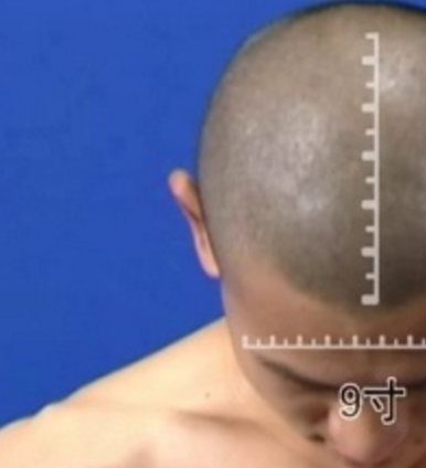 絡(luò)卻穴的作用