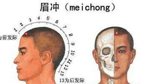 眉沖穴的示意圖