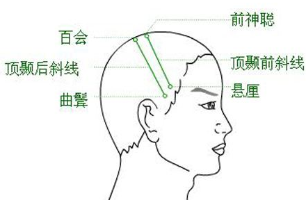 前頂穴作用