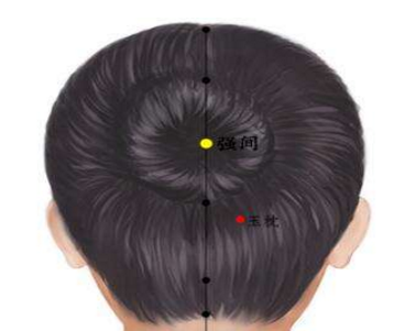 強(qiáng)間穴主治疾病