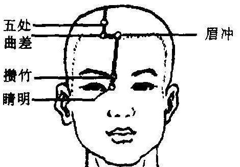 曲差穴的示意圖