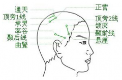 經(jīng)常按摩通天穴遠離鼻炎鼻塞！通天穴的按摩方法