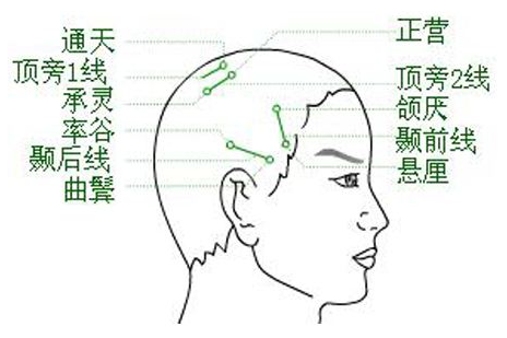 通天穴位的示意圖