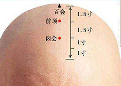 囟會穴名解