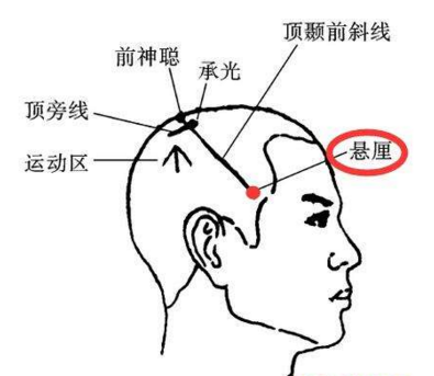 懸厘穴位示意圖