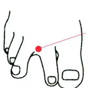 內(nèi)庭穴的準(zhǔn)確位置及按摩