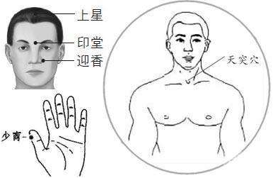 天突穴的示意圖