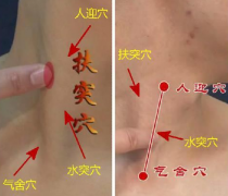 水突穴的位置及其水突穴針刺治療偏頭痛的方法詳解！