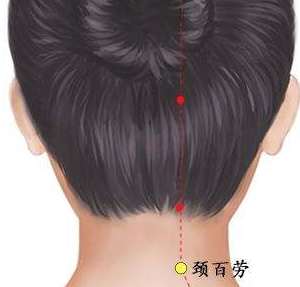 頸百勞穴的針灸
