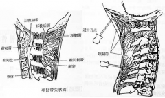 頸部開(kāi)放性損傷的治療方法及其并發(fā)癥有哪些？