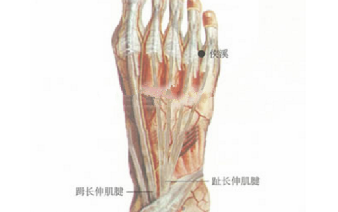 俠溪穴主治疾病有哪些