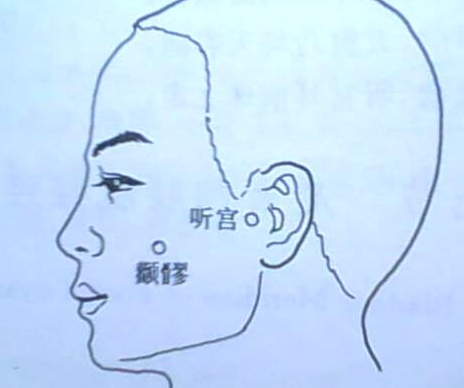 顴髎穴功效