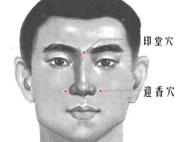 內(nèi)迎香穴的圖片