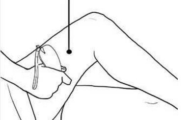 風(fēng)市穴的圖片