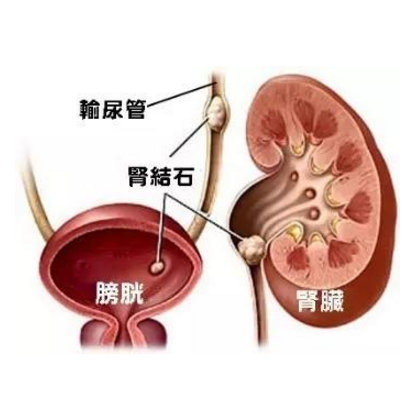 從尿液看腎臟健康，這些腎病癥狀你有嗎？