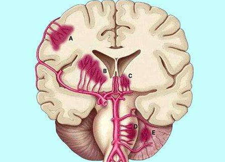 腦外傷伴發(fā)的精神障礙
