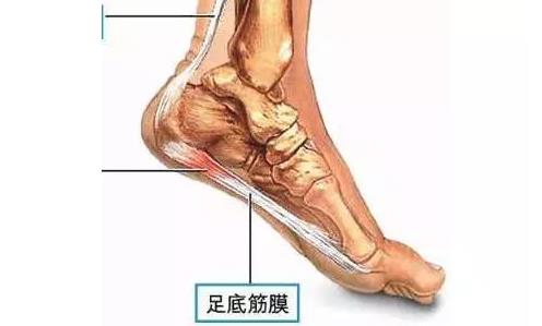 足底三角，不能穿高跟鞋最好別穿！