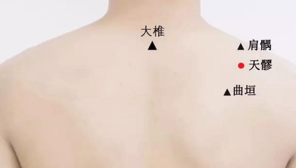 天髎穴的圖片