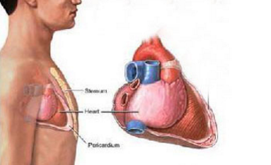 肺、胸膜阿米巴病會傳染嗎