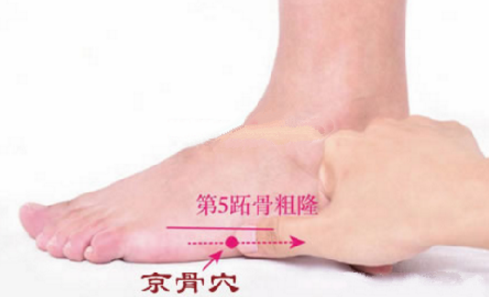 針刺京骨穴治療肩背肌筋膜炎的方法