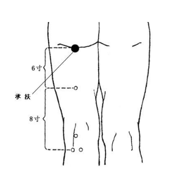 承扶穴疼痛怎么辦？它的