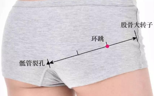 環(huán)跳穴位置
