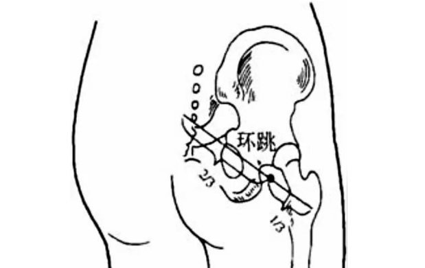 環(huán)跳穴主治疾病
