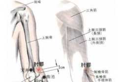 中醫(yī)治療網(wǎng)球肘之要穴——肘髎穴，肘髎穴位置怎么找？