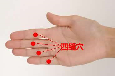 四縫穴位位置