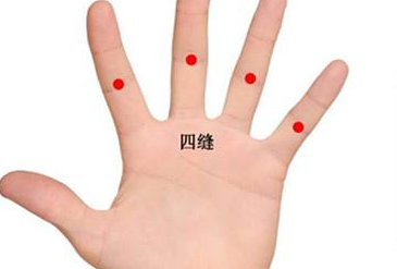 四縫穴的刺灸法
