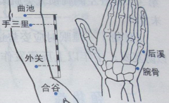 中醫(yī)治療落枕的特效穴——腕骨穴，腕骨穴的位置怎么找？