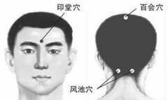 中醫(yī)教你按摩百會穴治療