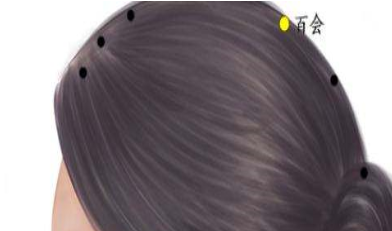 百會(huì)穴位位置