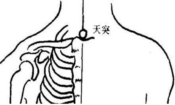 天突穴的準(zhǔn)確位置圖