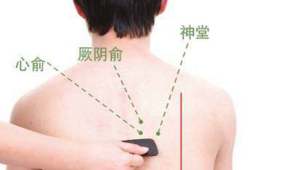 厥陰俞穴穴位配伍