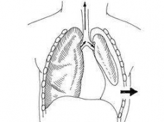 閉合性氣胸的食療保健及其治療方法介紹！