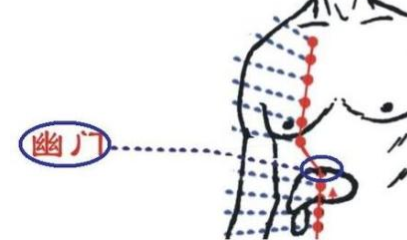 幽門(mén)穴的圖片