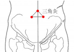 中醫(yī)灸三角灸穴治療婦女不孕及其三角灸穴位置！
