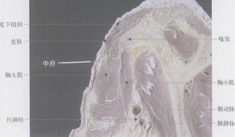 中府穴的按摩方法