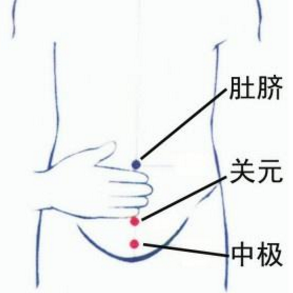 中極穴的準(zhǔn)確位置在哪？