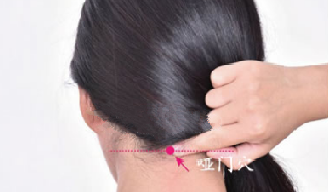 啞門穴穴位配伍