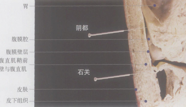 陰都穴主治疾病