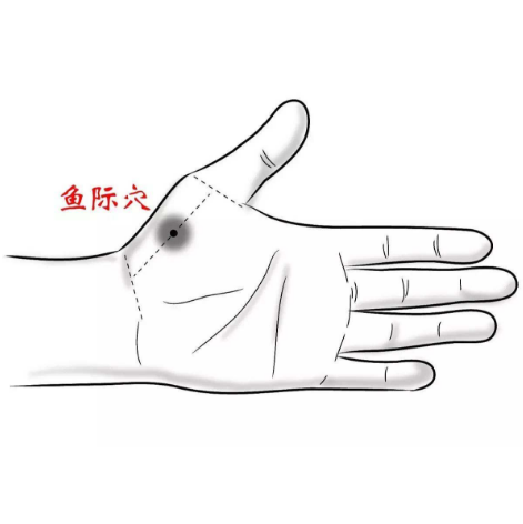 魚際穴的準(zhǔn)確位置在哪？中醫(yī)教你正確按摩魚際穴能快速止咳！