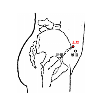 五樞穴疼痛怎么回事？中醫(yī)教你正確定位五樞穴的準(zhǔn)確位置！